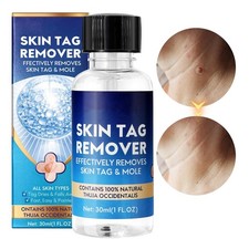 30ml Wart Remover Liquid