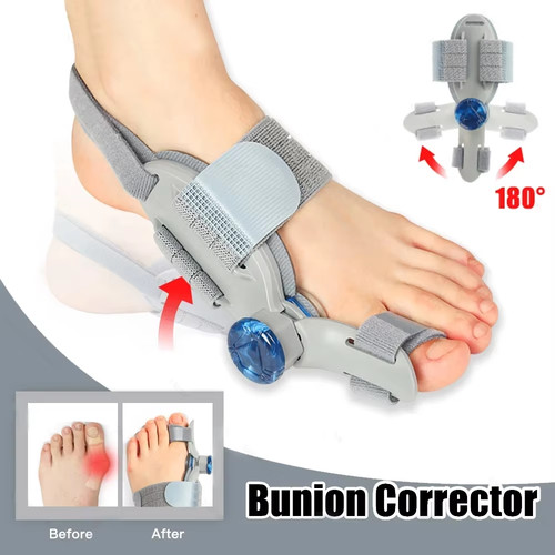 Nhs adjustable hallux valgus - adjustable,
