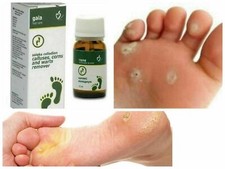 UK STOCK Remove CALLUSES CORNS