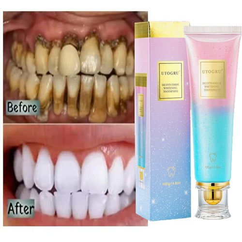 Niacinamide whitening - niacinamide,