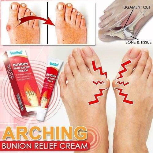Bunion pain relief cream - pain,