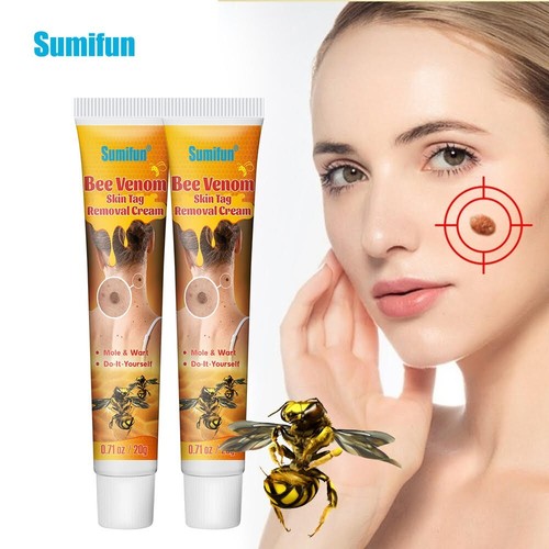 New 20g warts remover ointment - 20g,
