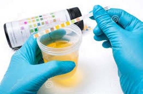Urine test strips 10 - 20,