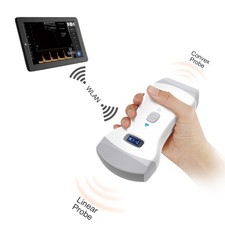 Handheld Wireless Ultrasound