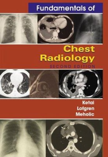 Fundamentals chest - fundamentals, of