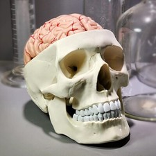 Human Skull with Brain, 11