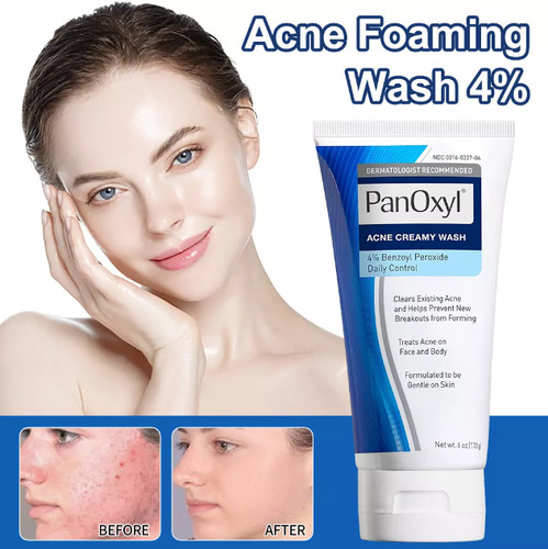 Acne foaming wash face - foaming,