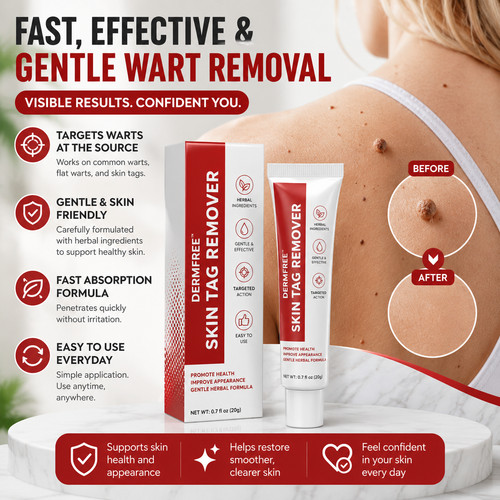 Strong skin tag - strong, remover