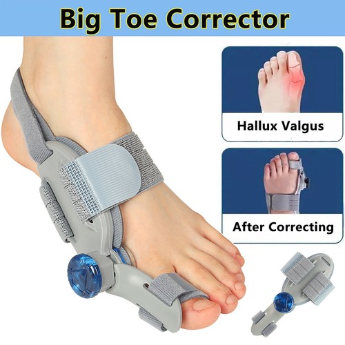 Nhs adjustable hallux - hallux, valgus