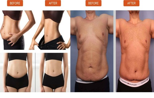 Unisex slim patch belly - belly, fat