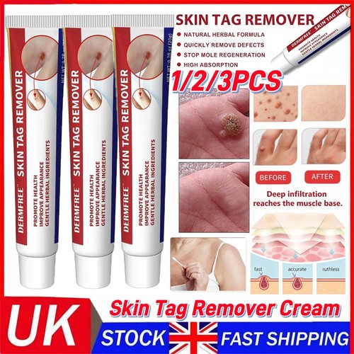 Strong skin tag remover - strong,