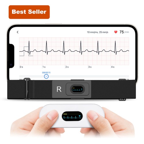 Checkme er2 mobile - mobile, ekg