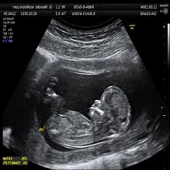 ultrasound for sale