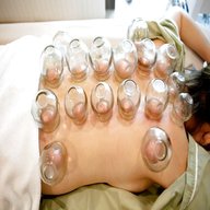 cupping for sale